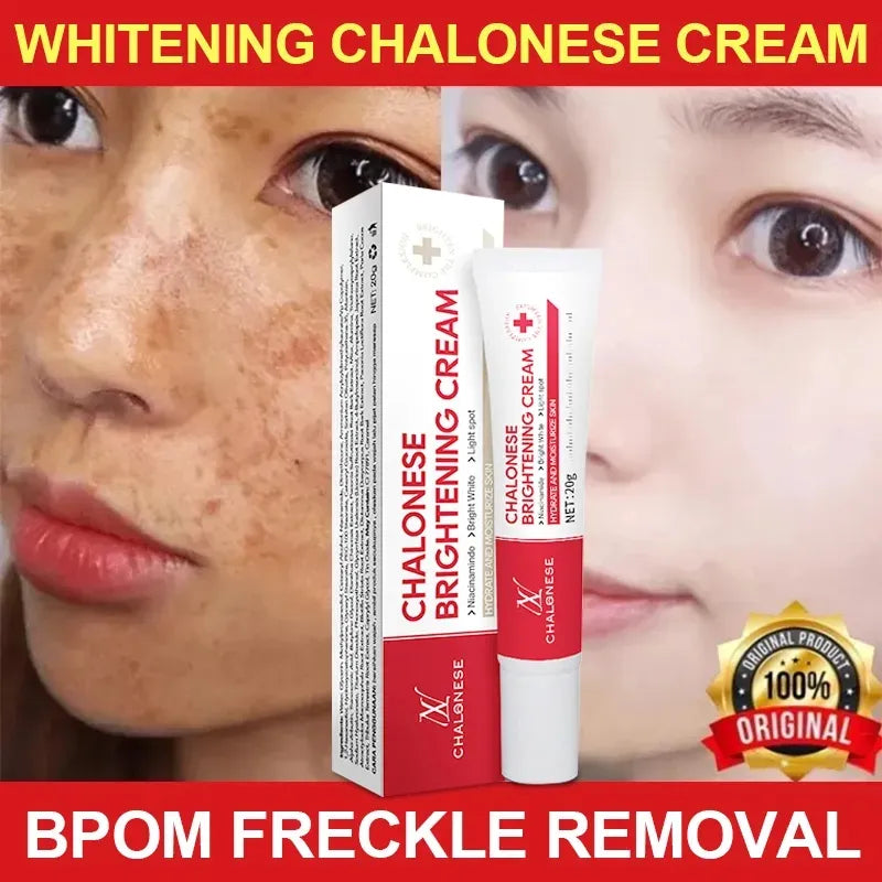 Chalonese Brightening Cream